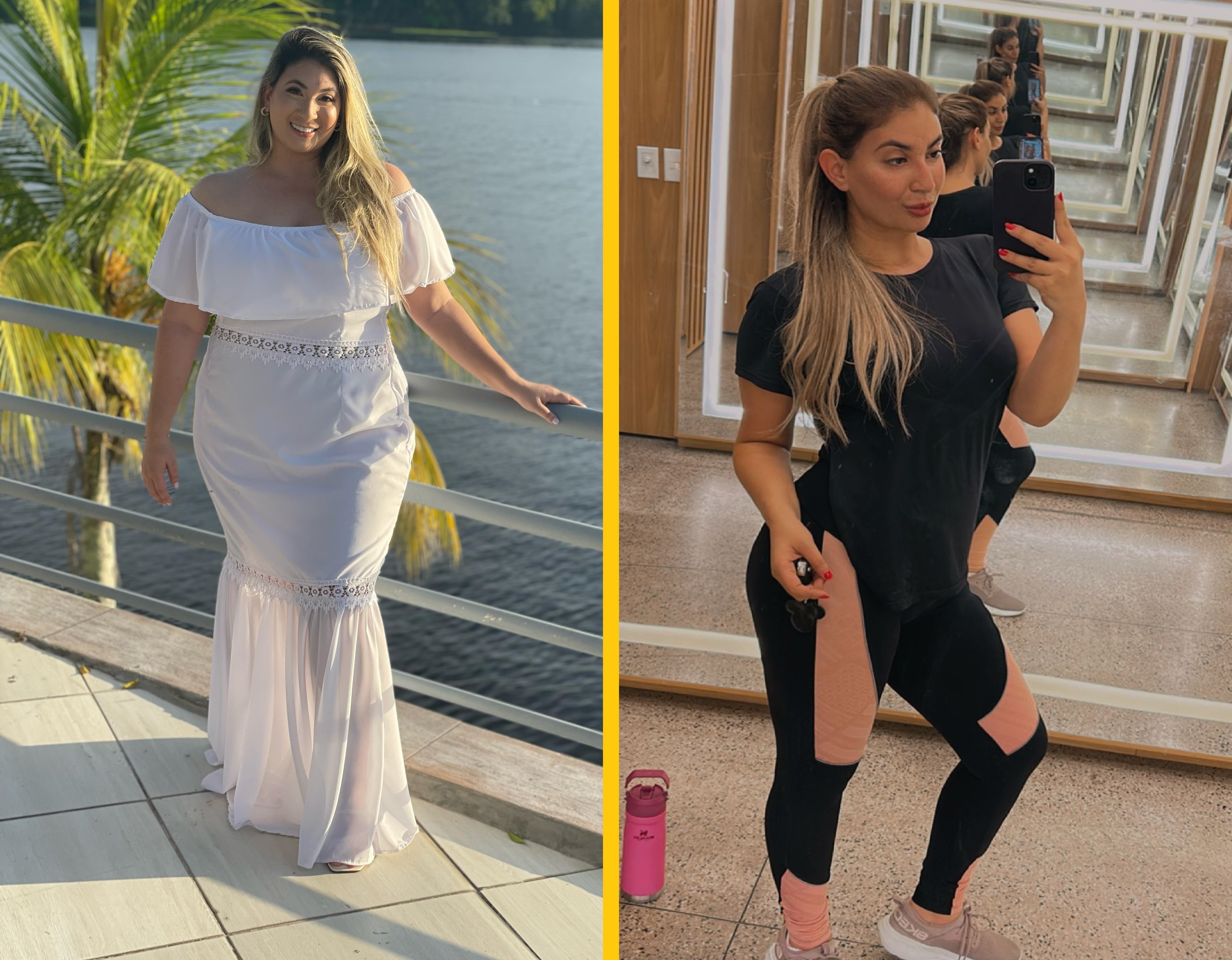 Antes e Depois 1
