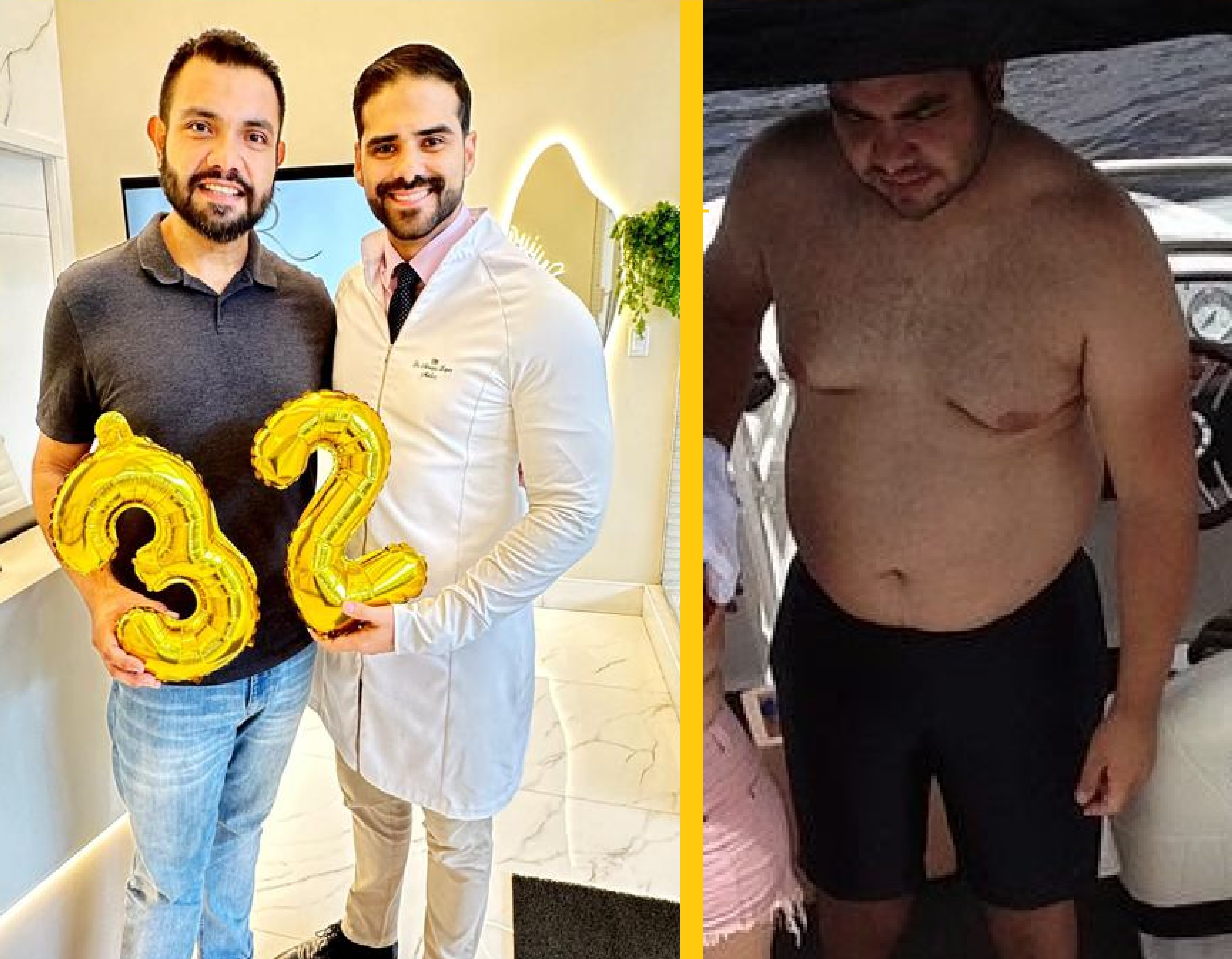 Antes e Depois 3